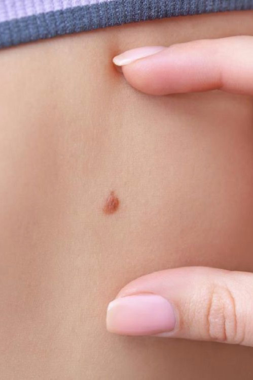 Chirurgia dermatologica